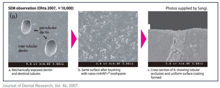 photos of tubular occlusions